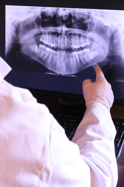 Best Emergency Tooth Extraction in Palmetto, GA