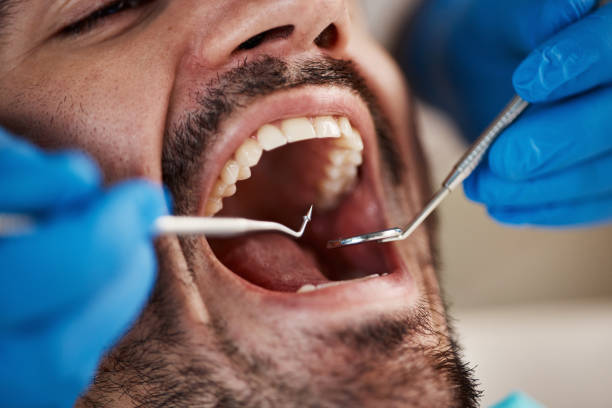 Best Emergency Treatment for Dental Infections or Abscesses in Palmetto, GA